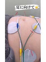 ヒューマン鍼灸接骨院/体幹トレーニングand鍼