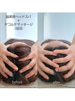 ネマウム(nemaum)/ドライヘッドスパ