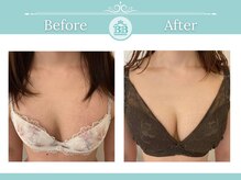 美人バスト 浜松店/◇ バストアップ &nbsp;BeforeAfter◇