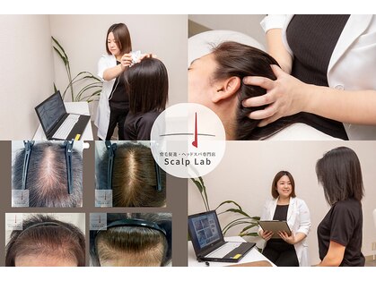 スカルプラボ 倉敷店(Scalp Lab)の写真