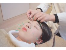 カリーナ(Carina)の雰囲気（美容鍼でお顔の悩み(くすみ/たるみ/肌荒れなど)にアプローチ◎）