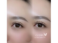 エテルニテ(eternite)/