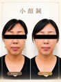 カンナ 福岡(Canna) お顔だけでなく身体から整えて、すっきり小顔へ