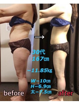 アンリール 旭川店(Anrire)/BODY施術のお客様です!