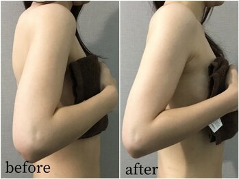 ヴィノ アイサロン(VINNO eyesalon)/巻き肩矯正で美姿勢に★