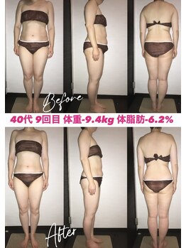 シェイプ 浜松本店/憧れ小顔も目指そうシェイプ