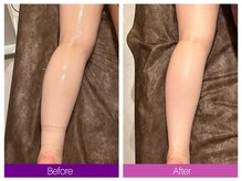 クレヴィア バイ サイバーエステ(CREBIA)/ふくらはぎ【むくみ撃退★】