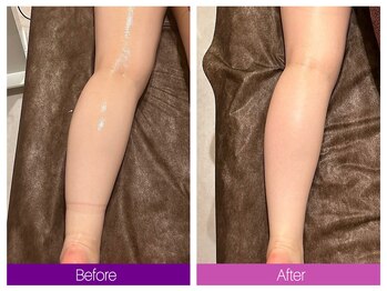 クレヴィア バイ サイバーエステ(CREBIA)/ふくらはぎ【むくみ撃退★】