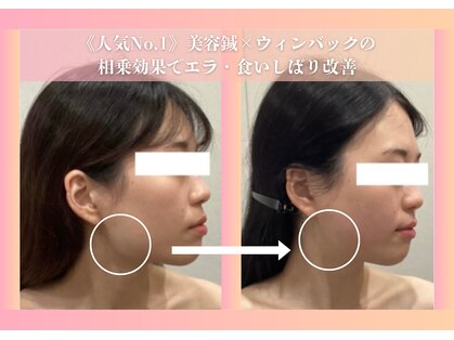 ミプラス鍼灸スタジオの写真