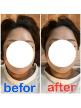 ボディプラス(BODY+)/