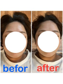 ボディプラス(BODY+)/