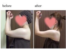 ウィズマツオカ 光の森店/背中・二の腕集中！