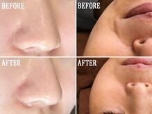 コウベ美容鍼灸治療院(KOBE美容鍼灸治療院)