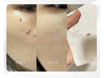 Kino Beauty Salon二子玉川店 ローマピンク/ホワイトラボ/脂肪冷却/シミ/メラニンケア/ホワイトラボ