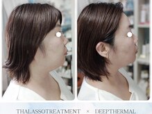 ティアス(t-us)の雰囲気（タラソ×サーマル リフトUP、美白、ニキビケア、毛穴、シワ改善）