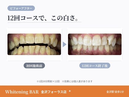 ホワイトニングバー 金沢フォーラス店の写真