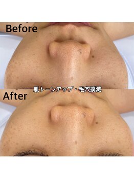 ウルル(ULuLu)/ビフォーアフター