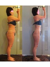 痩身 セル脂肪専門 スタイルデザイン/2023ベストボディSD★総合優勝３