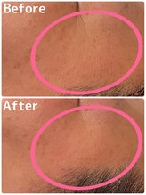 シュシュ 立川駅前(ChouChou)/一度でこの効果！！