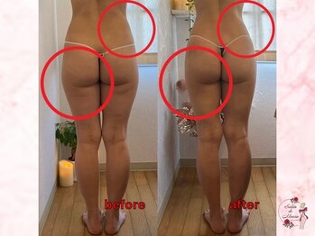 サロンドモアロ(Salon de Moaro)/Before/After