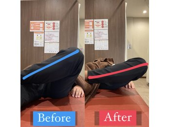 ナオル整体 宮崎院(NAORU整体)/30代男性施術事例【股関節改善】