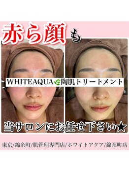 ホワイトアクア 錦糸町店(WHITE AQUA)/ハーブピーリング/東京/錦糸町
