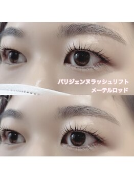 レディエント(Radiant)/パリジェンヌ/メーテルロッド