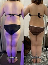 輝 らいと/ビフォーアフター（背面）