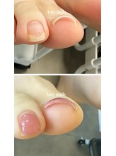 アーティネイルズ(Aaty Nails)/通常２～３回で