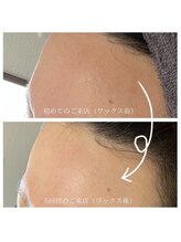 ここはな/フェイシャル脱毛ワックス