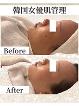 ドレス(dress)/1回目でシミが薄く