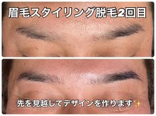 リエル(RIEL)/眉脱毛