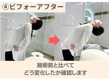 フィクシブ 上野(FIXIBE)/目で見てわかる圧倒的変化