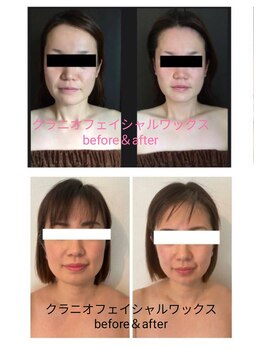 ビー ファクトリー(B FACTORY)/クラニオフェイシャルワックス