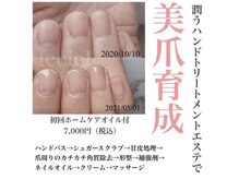 コンプレックスが『好き』に変わる初回特典　育成オイル付き