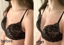 ブレスト 新宿本店(Breast)
