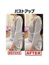 フォルム ボディアンドフェイス 恵比寿(Forme)/バストアップにも