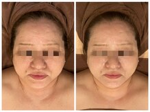 ビュップ 海老名店(美up)/【グロッティフェイシャル】