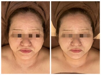 ビュップ 海老名店(美up)/【グロッティフェイシャル】