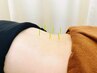【完全予約制】鍼施術 45分 4,000円
