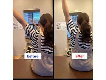 ドクターズリゾート(Dr's Resort:)/上半身構造調整例