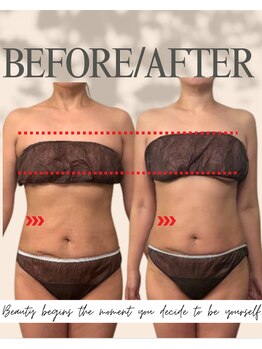 エイエービジュー(Aa.bijou)/50代 女性