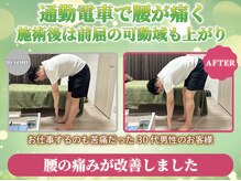 リボディ調整院 上野(Re-body調整院)の雰囲気（腰痛があった30代男性。施術後は前屈しても痛くなくなった。）