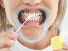 アエラ(AERA)/【ホワイトニング】