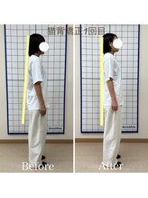クローバー整体院/姿勢改善×美容整体(施術1回目)