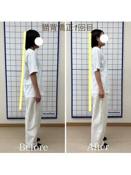 クローバー整体院/姿勢改善×美容整体(施術1回目)