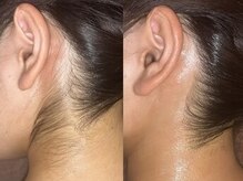 シンボディメイク 恵比寿(SiN BODY MAKE)/【色気ある襟足】うなじワックス