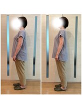 隠れが美容整体ウェルネ 糟屋院/51歳　81.4kg→70.1kg -11.3kg