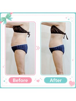エミナル(EMINAL)の写真/最新ウィンバックのラジオ波で引き締まった美しいボディへ☆オーダーメイド施術で本格ダイエット！