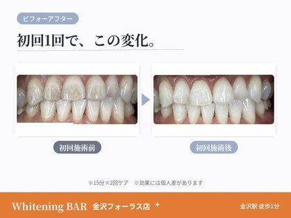 ホワイトニングバー 金沢フォーラス店の写真